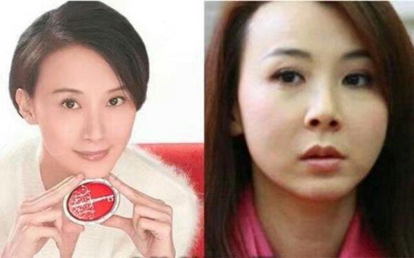 整容失败的明星都有谁？