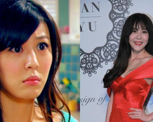 整容失败的明星都有谁？