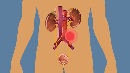 小便刺痛是什么原因造成的?