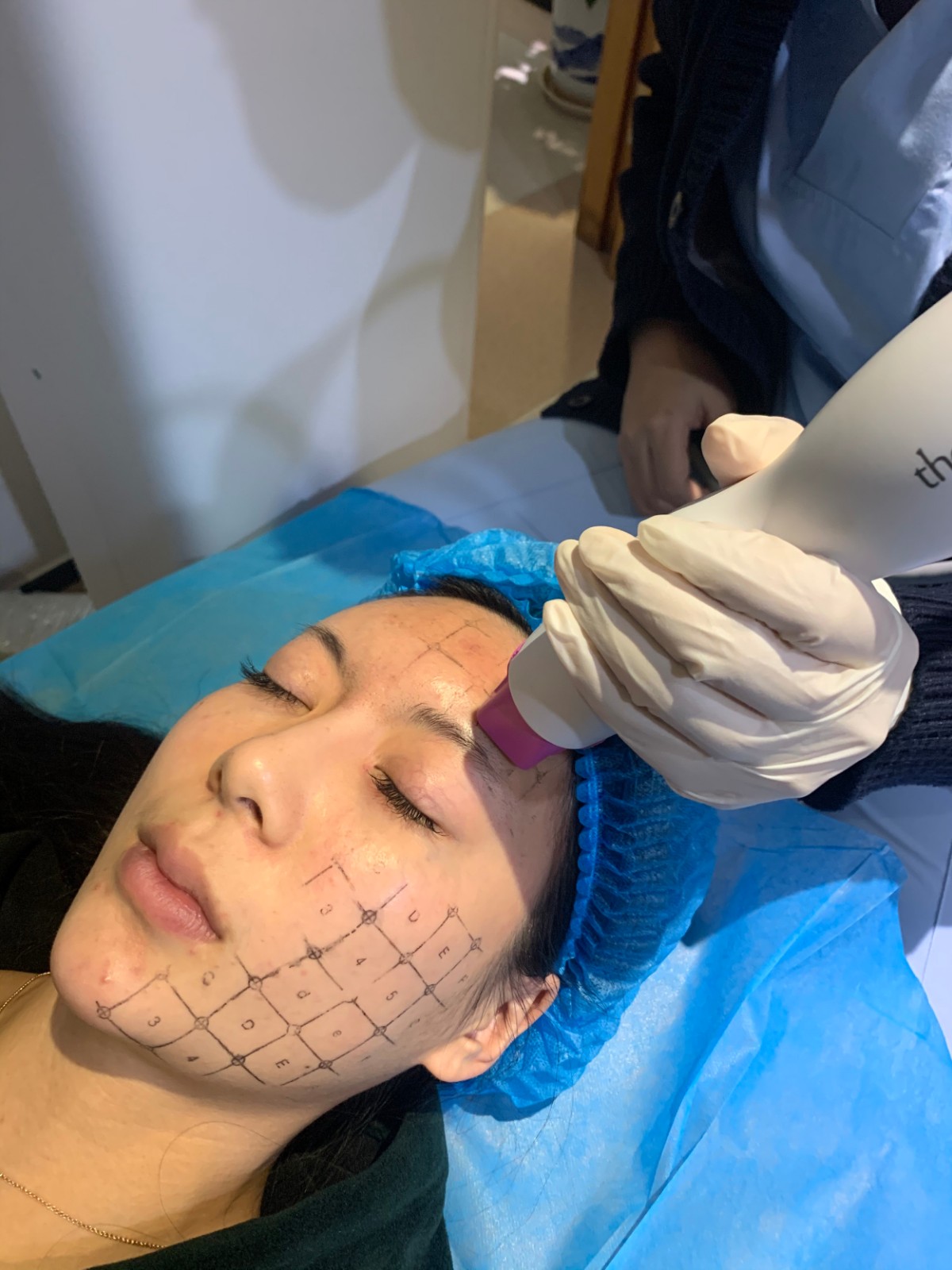 热玛吉做一次需要多少钱呢？？