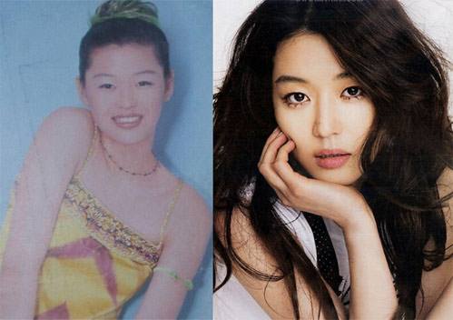 全智贤是整容了吗?