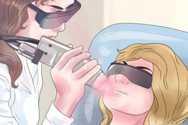 激光去痘印大概多少钱