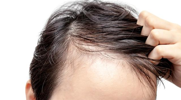 产生白发的原因都有哪些