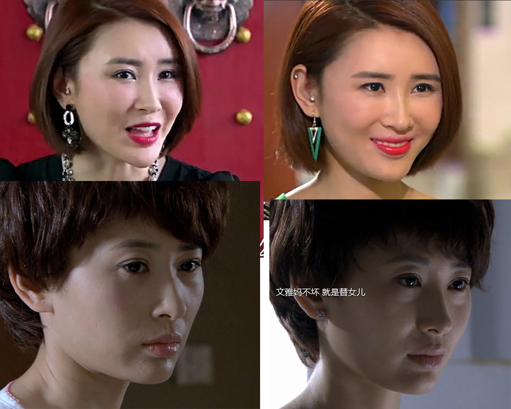 吕夏葳整容过吗？感觉她面目表情僵硬怀疑整容的。