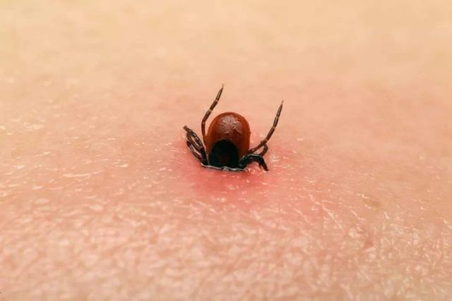 什么是蜱虫病?蜱虫病最容易在哪个季节发生?