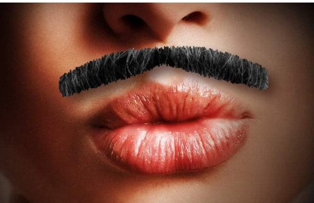 激光脱毛胡子多少钱啊?