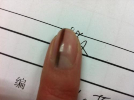 肝脏不好,有哪些症状?