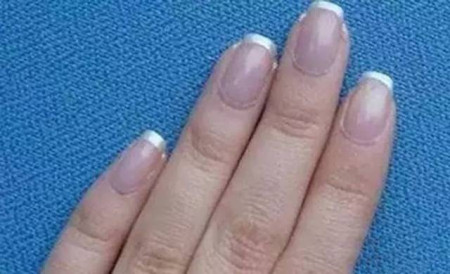 肝脏不好,有哪些症状?