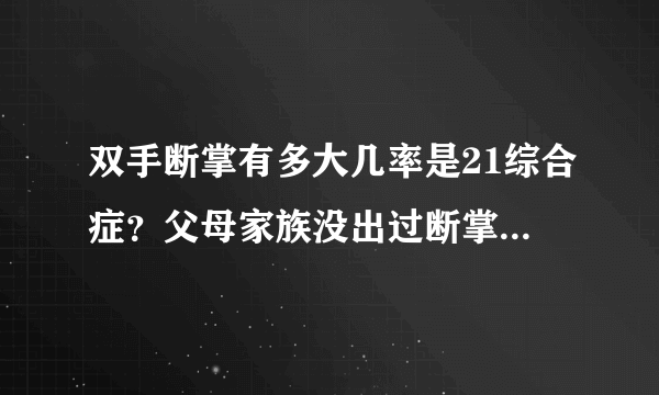双手断掌有多大几率是21综合症？父母家族没出过断掌的，谢谢帮帮忙我真的很担心。
