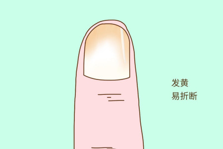 肝脏不好,有哪些症状?