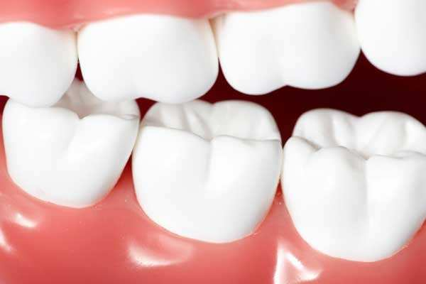 牙周炎怎么治疗好？