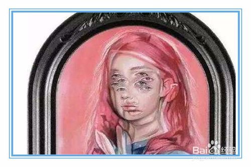 眼睛散光怎么恢复