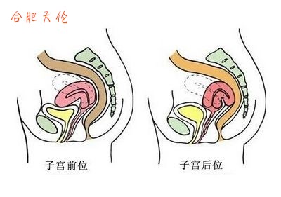 子宫后位是什么意思