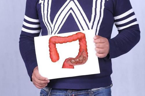 放屁很臭是怎么回事?