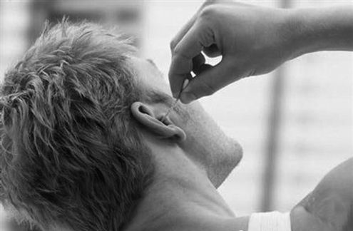 耳膜穿孔怎么治愈！