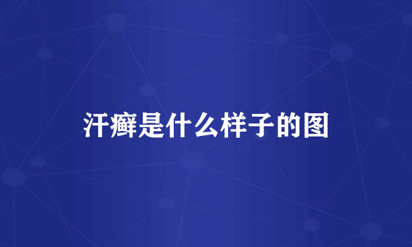 汗癣是什么样子的图