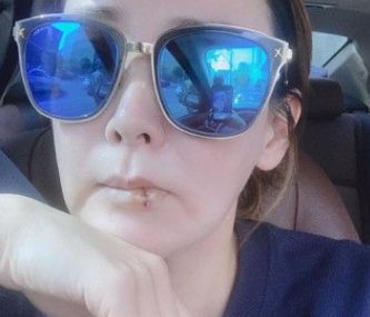 李尚雅因整容后遗症脸僵无比,自曝有副作用,她都经历了什么?