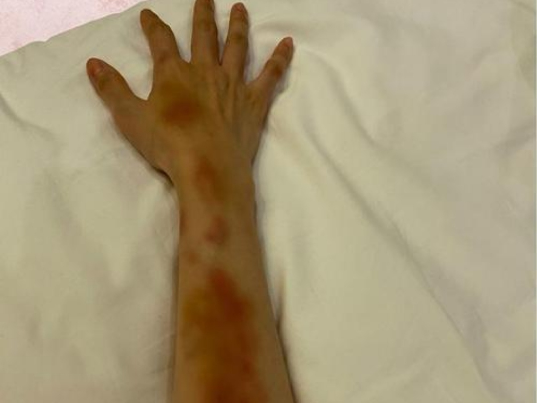 陈小纭女子射箭冠军,她取得冠军的背后都付出了什么努力?