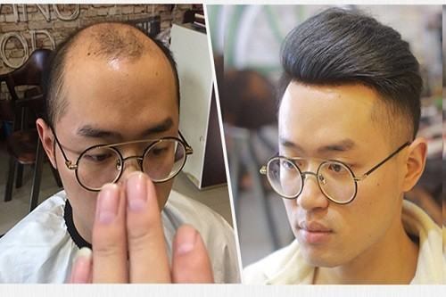 假发一般价格多少?