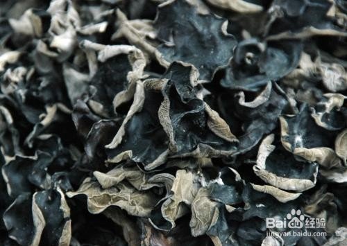 肾结石疼痛怎么缓解?