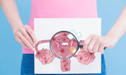 子宫内膜异位的原因是什么