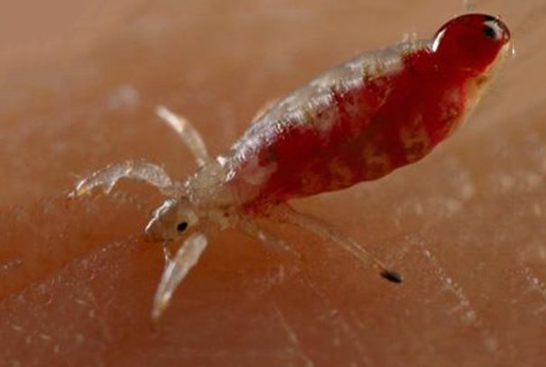 怎么会有阴虱，是怎么形成的？