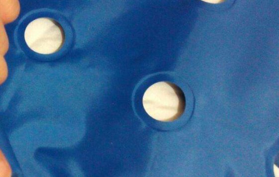 怎么治疗褥疮？