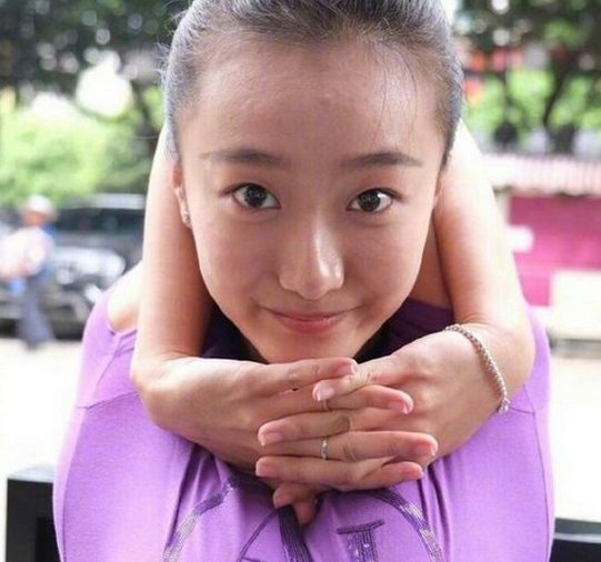 美女四肢可拧麻花是一种病吗？