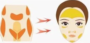 面部自体脂肪移植