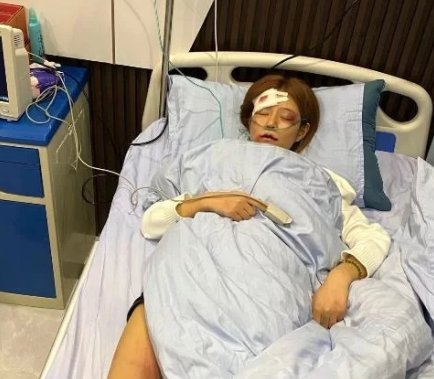 网红王多鱼遭男友家暴入院,女性遭遇家暴该如何维权呢?