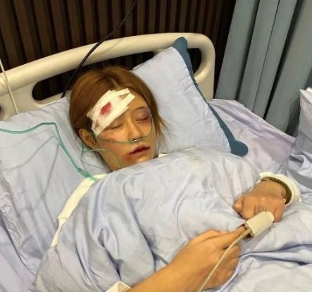 网红王多鱼遭男友家暴入院,女性遭遇家暴该如何维权呢?