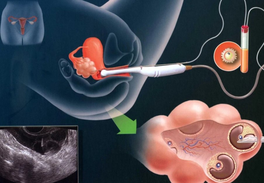 大学女生15万元卖卵子,收卵子人的做法是否合法?