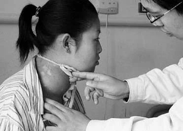 人大代表建议将肿瘤筛查纳入医保，你支持吗？