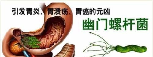 请问治疗幽门螺杆菌感染的四联疗法是哪四种药