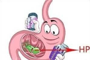 请问治疗幽门螺杆菌感染的四联疗法是哪四种药