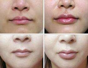 嘴唇厚是什么原因，具体说说