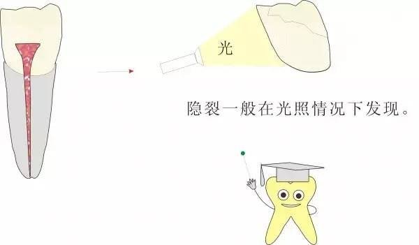 牙齿为什么会痛呢?