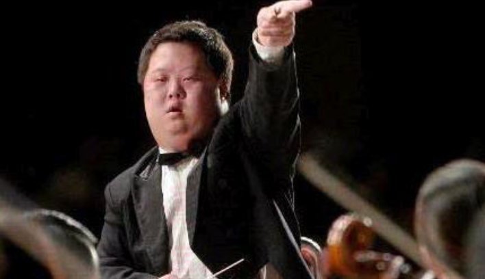 21三体综合症是什么？