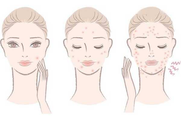 皮肤哪些地方瘙痒可能预示你的身体出现问题？该如何预防？