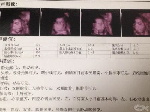 孕晚期28周后，胎儿一周能长多大？