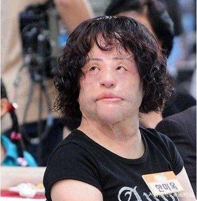 韩国电风扇阿姨韩慧景，沉迷整容变怪物？整容可能变毁容吗？
