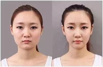 瘦脸霜怎么用法