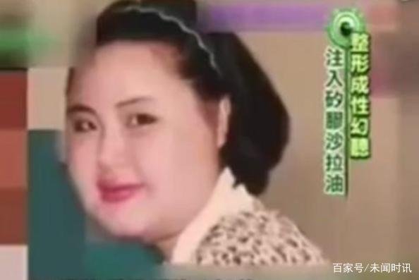 韩国电风扇阿姨韩慧景，沉迷整容变怪物？整容可能变毁容吗？