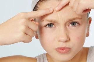 脸上老是长痘痘是什么原因啊?