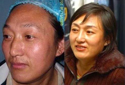 举重冠军邹春兰现状如何?