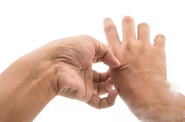 手麻是什么原因