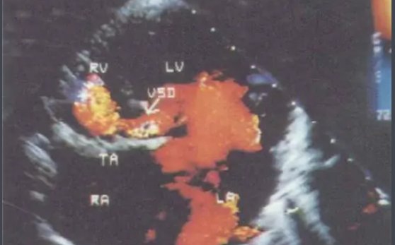 cdfi是什么意思？