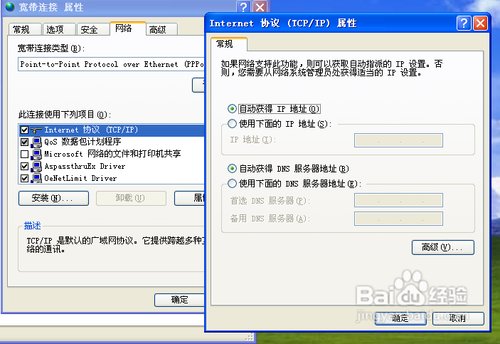怎么设置本地连接