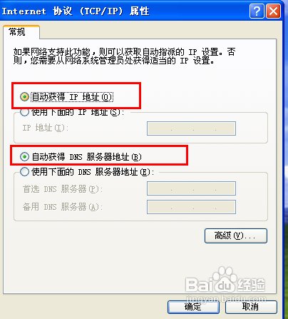 怎么设置本地连接