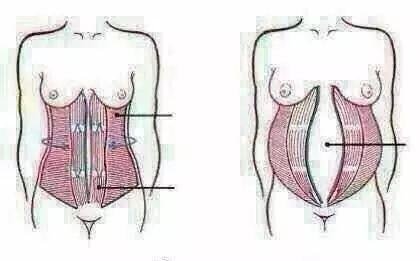 什么是做腹直肌？